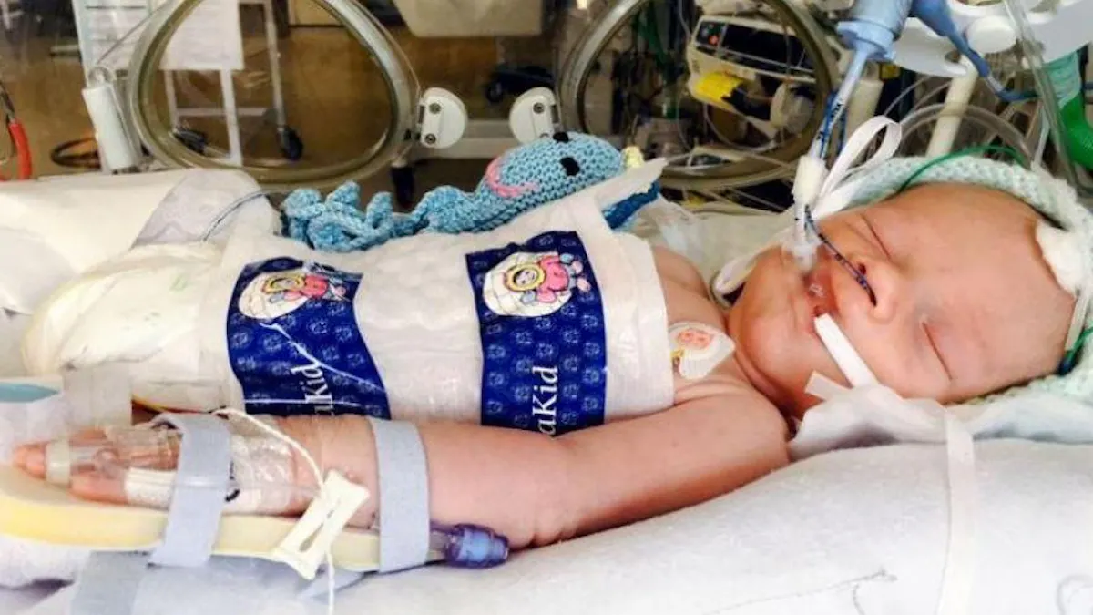 Declare En Etat De Mort Cerebrale Un Bebe S Est Remis Miraculeusement Parents Fr Declare En Etat De Mort Cerebrale Un Bebe S Est Remis Miraculeusement Parents Fr