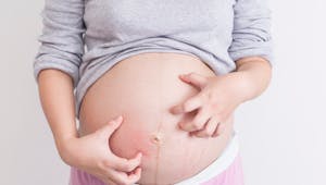 Enceinte et atteinte de lupus : tout sur le lupus pendant la grossesse