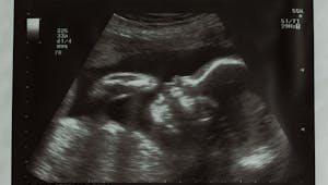 Semaine 10 de grossesse - 12 SA