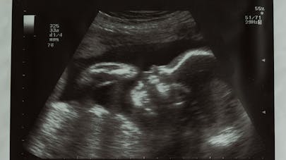 10 Semaine De Grossesse 12 Sa De Grossesse 10eme Semaine Parents Fr 10 Semaine De Grossesse 12 Sa De Grossesse 10eme Semaine Parents Fr