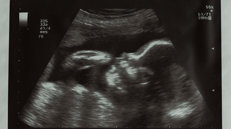 10 Semaine De Grossesse 12 Sa De Grossesse 10eme Semaine Parents Fr 10 Semaine De Grossesse 12 Sa De Grossesse 10eme Semaine Parents Fr