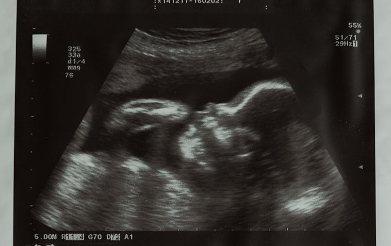 10 Semaine De Grossesse 12 Sa De Grossesse 10eme Semaine Parents Fr 10 Semaine De Grossesse 12 Sa De Grossesse 10eme Semaine Parents Fr