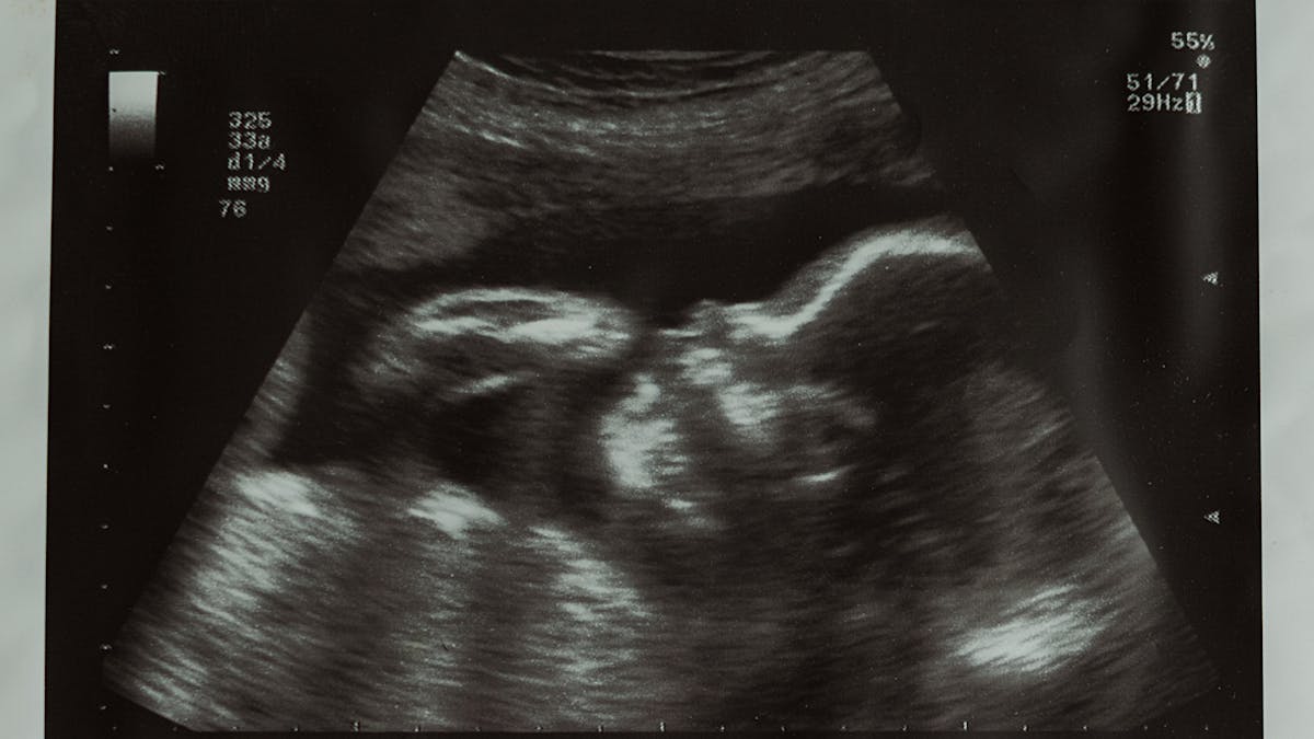 10 Semaine De Grossesse 12 Sa De Grossesse 10eme Semaine Parents Fr 10 Semaine De Grossesse 12 Sa De Grossesse 10eme Semaine Parents Fr