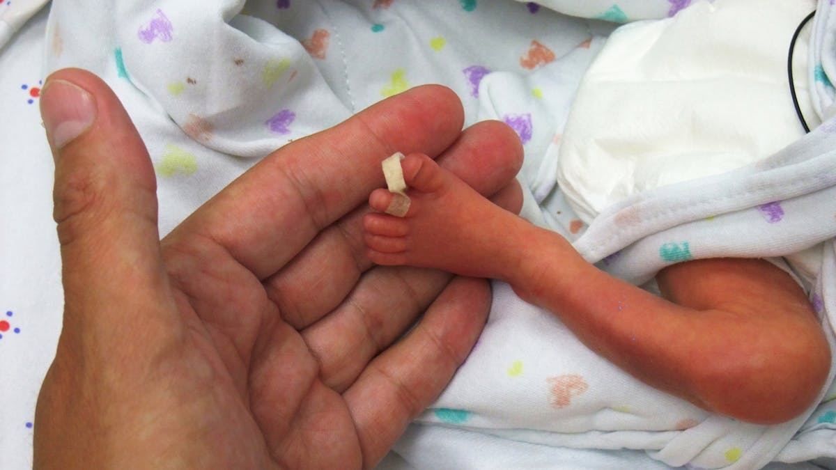 Ne A 23 Semaines De Grossesse Ce Bebe A Dejoue Tous Les Pronostics Des Medecins Parents Fr Ne A 23 Semaines De Grossesse Ce Bebe A Dejoue Tous Les Pronostics Des Medecins Parents Fr