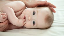 Syndactylie : bébé a les doigts collés
