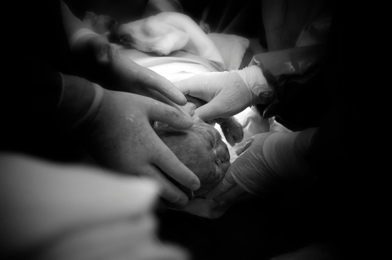 Cesarienne Les Incroyables Images D Un Bebe Qui Sort Du Ventre Et Tombe De Sommeil Parents Fr Cesarienne Les Incroyables Images D Un Bebe Qui Sort Du Ventre Et Tombe De Sommeil Parents Fr