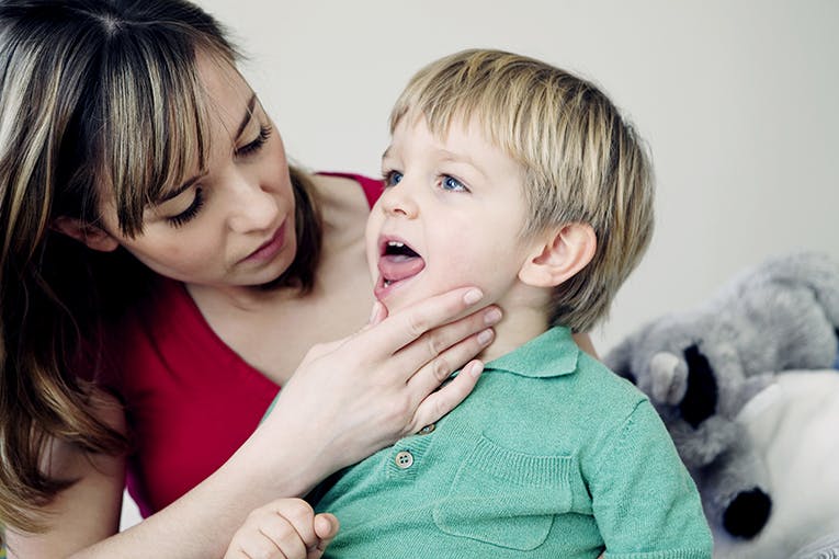 Aphtes Que Faire Pour Les Eviter Et Les Soigner Chez L Enfant Parents Fr