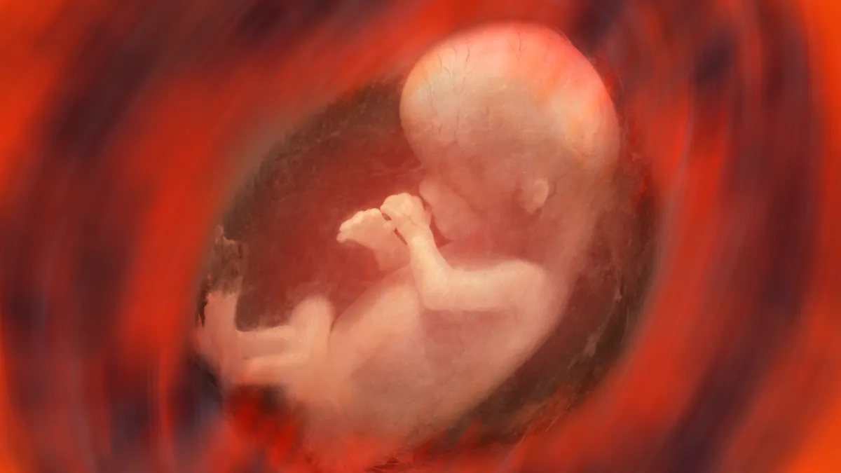 Ces Muscles De Lezard Qu Ont Les Bebes In Utero Et Qui Disparaissent A La Naissance Parents Fr Ces Muscles De Lezard Qu Ont Les Bebes In Utero Et Qui Disparaissent A La Naissance Parents Fr