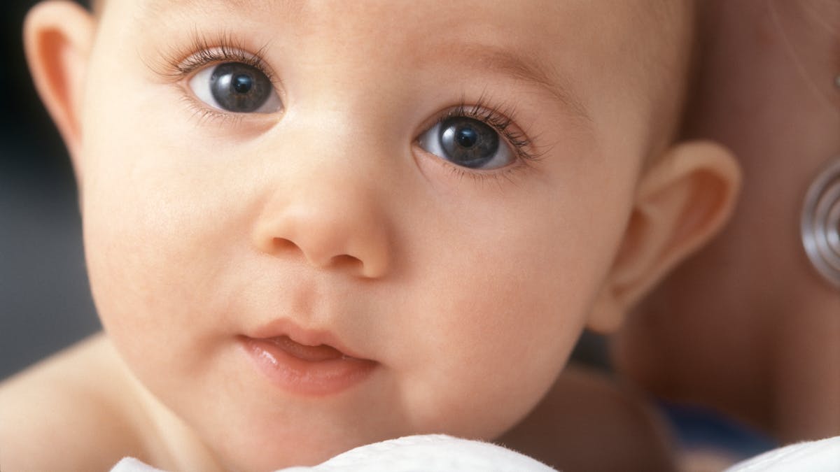 Mon Bebe A Les Oreilles Decollees Parents Fr Mon Bebe A Les Oreilles Decollees Parents Fr