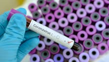 Ce qu'il faut savoir sur le nouveau coronavirus identifié en Chine