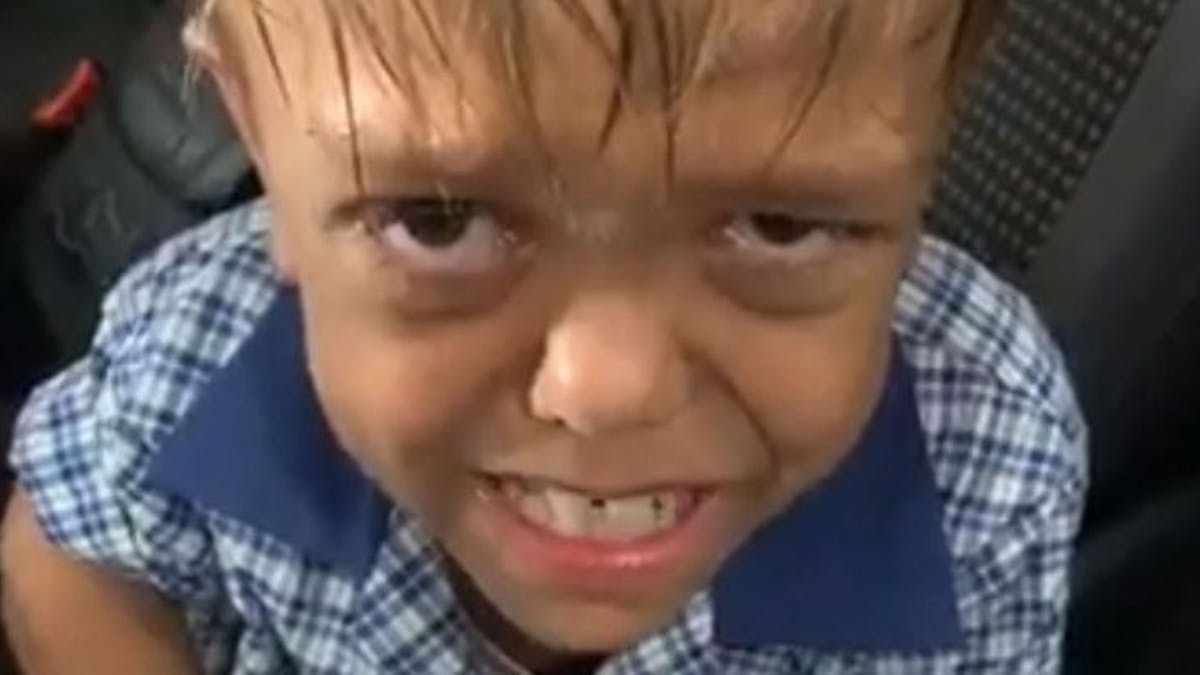 Harcelement La Bouleversante Video Du Petit Quaden Atteint De Nanisme A Fait Le Tour Du Monde Parents Fr Harcelement La Bouleversante Video Du Petit Quaden Atteint De Nanisme A Fait Le Tour Du Monde Parents Fr