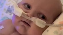 Après 2 opérations à coeur ouvert, un bébé sourit pour la première fois