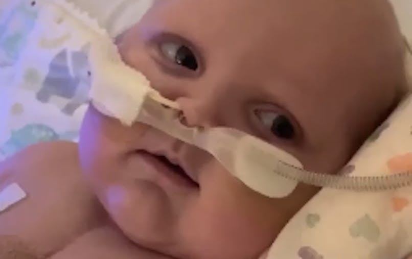 Opere 2 Fois A Coeur Ouvert Un Bebe De 6 Mois Sourit Pour La 1ere Fois Parents Fr Opere 2 Fois A Coeur Ouvert Un Bebe De 6 Mois Sourit Pour La 1ere Fois Parents Fr