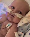 Après 2 opérations à coeur ouvert, un bébé sourit pour la première fois