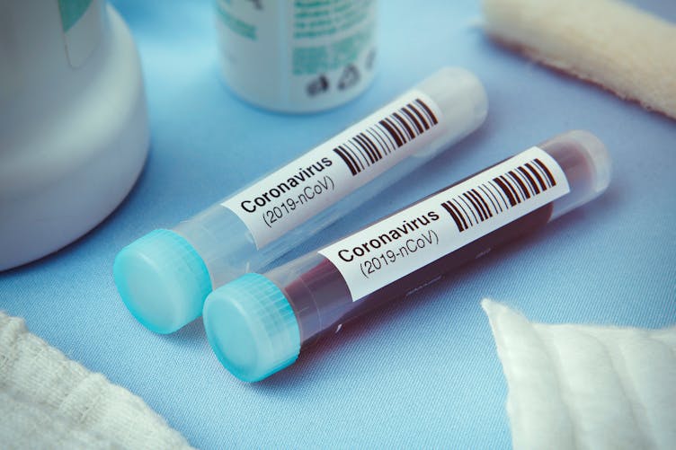 Coronavirus : deux souches différentes seraient en circulation selon une étude
