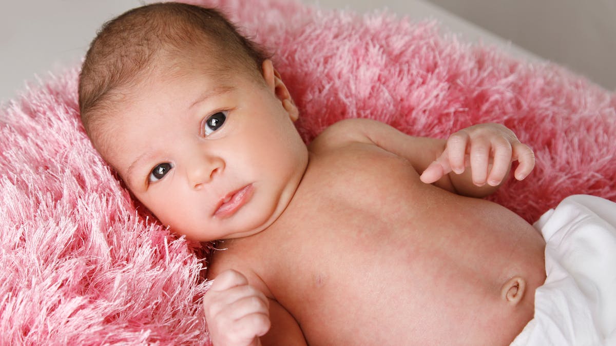 Hernie Ombilicale Le Nombril De Bebe Ressort Parents Fr Hernie Ombilicale Le Nombril De Bebe Ressort Parents Fr