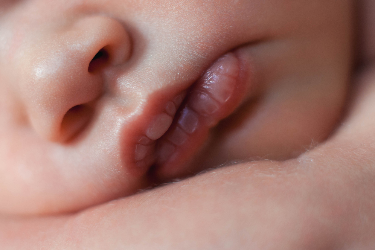 Un Bebe Nait Avec Deux Bouches Parents Fr