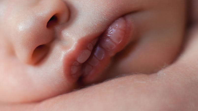 Un Bebe Nait Avec Deux Bouches Parents Fr Un Bebe Nait Avec Deux Bouches Parents Fr