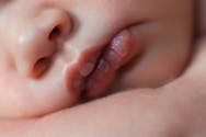Naissance : un bébé naît avec deux bouches