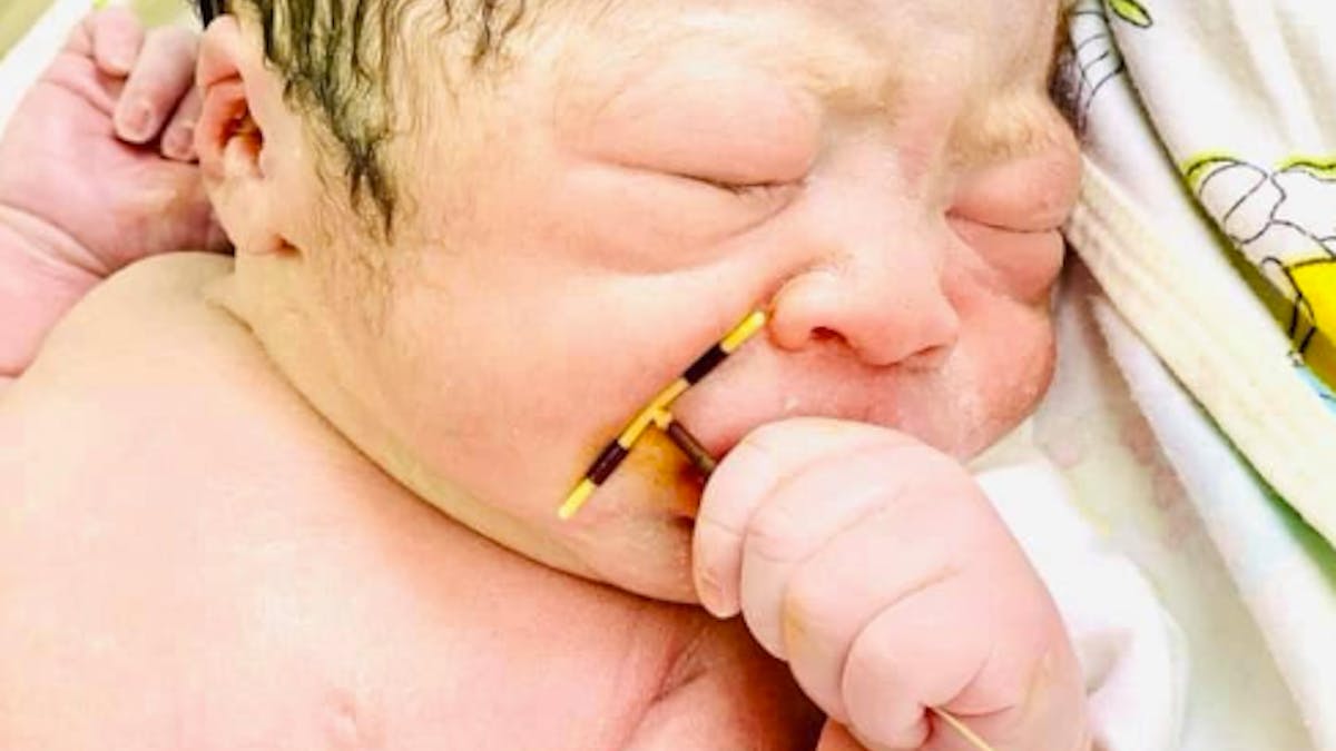 Ce Bebe Ne Avec Le Sterilet De Sa Mere Dans La Main La Photo Qui Fait Le Buzz Parents Fr Ce Bebe Ne Avec Le Sterilet De Sa Mere Dans La Main La Photo Qui Fait Le Buzz Parents Fr