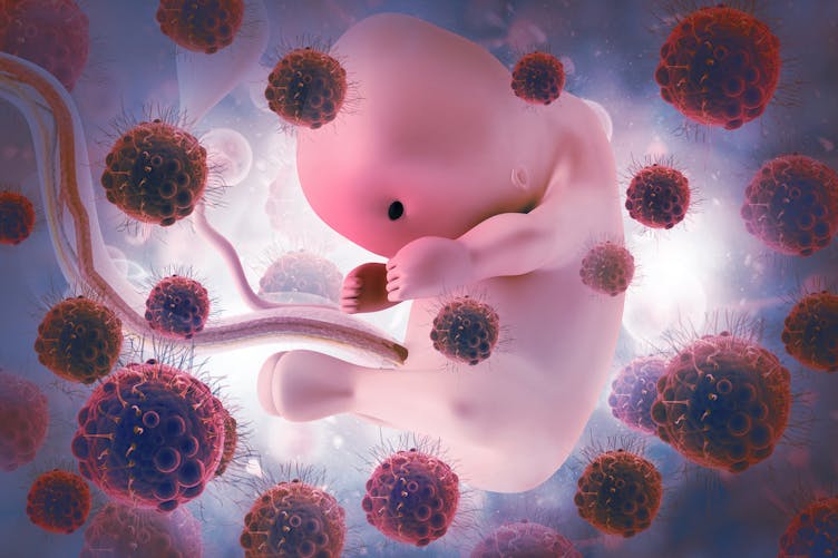 Coronavirus : pourquoi il passe rarement de la mère au foetus