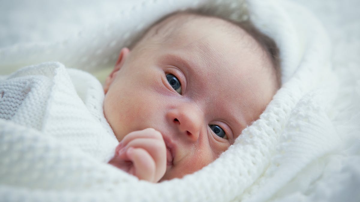 Trisomie 18 Definition Symptomes Prise En Charge Parents Fr Trisomie 18 Definition Symptomes Prise En Charge Parents Fr