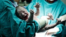 Grossesse extra-utérine : naissance rarissime d’un bébé viable qui a grandi dans l’ovaire de sa mère