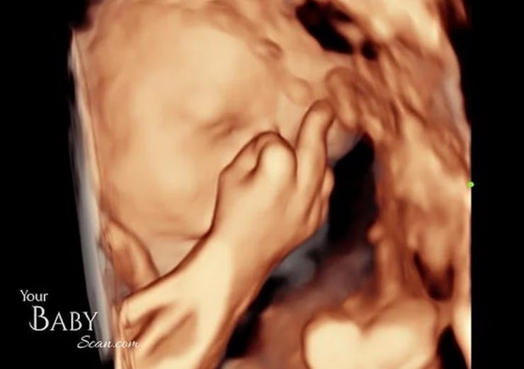 Echographie Un Futur Bebe Fait Un Doigt D Honneur Parents Fr Echographie Un Futur Bebe Fait Un Doigt D Honneur Parents Fr