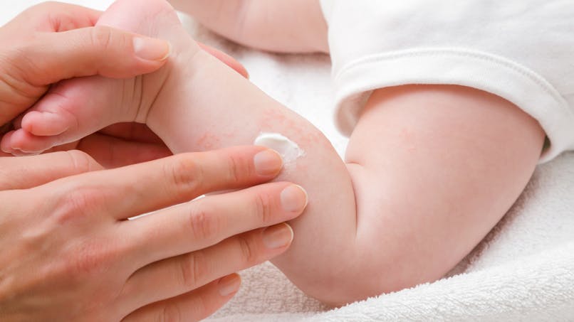 Furoncle Chez L Enfant Et Le Bebe Que Faire Parents Fr Furoncle Chez L Enfant Et Le Bebe Que Faire Parents Fr