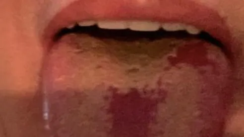 La Langue Covid Un Nouveau Symptome Du Coronavirus Parents Fr La Langue Covid Un Nouveau Symptome Du Coronavirus Parents Fr