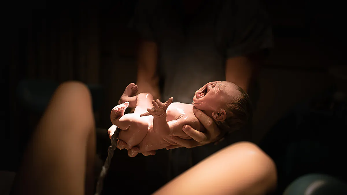 Naissance Pourquoi Les Premiers Pleurs Sont Si Importants Pour La Sante Du Bebe Parents Fr Naissance Pourquoi Les Premiers Pleurs Sont Si Importants Pour La Sante Du Bebe Parents Fr