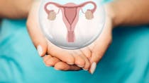 Kyste dermoïde ovarien : causes et traitements