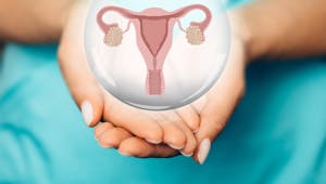 Kyste dermoïde ovarien : causes et traitements