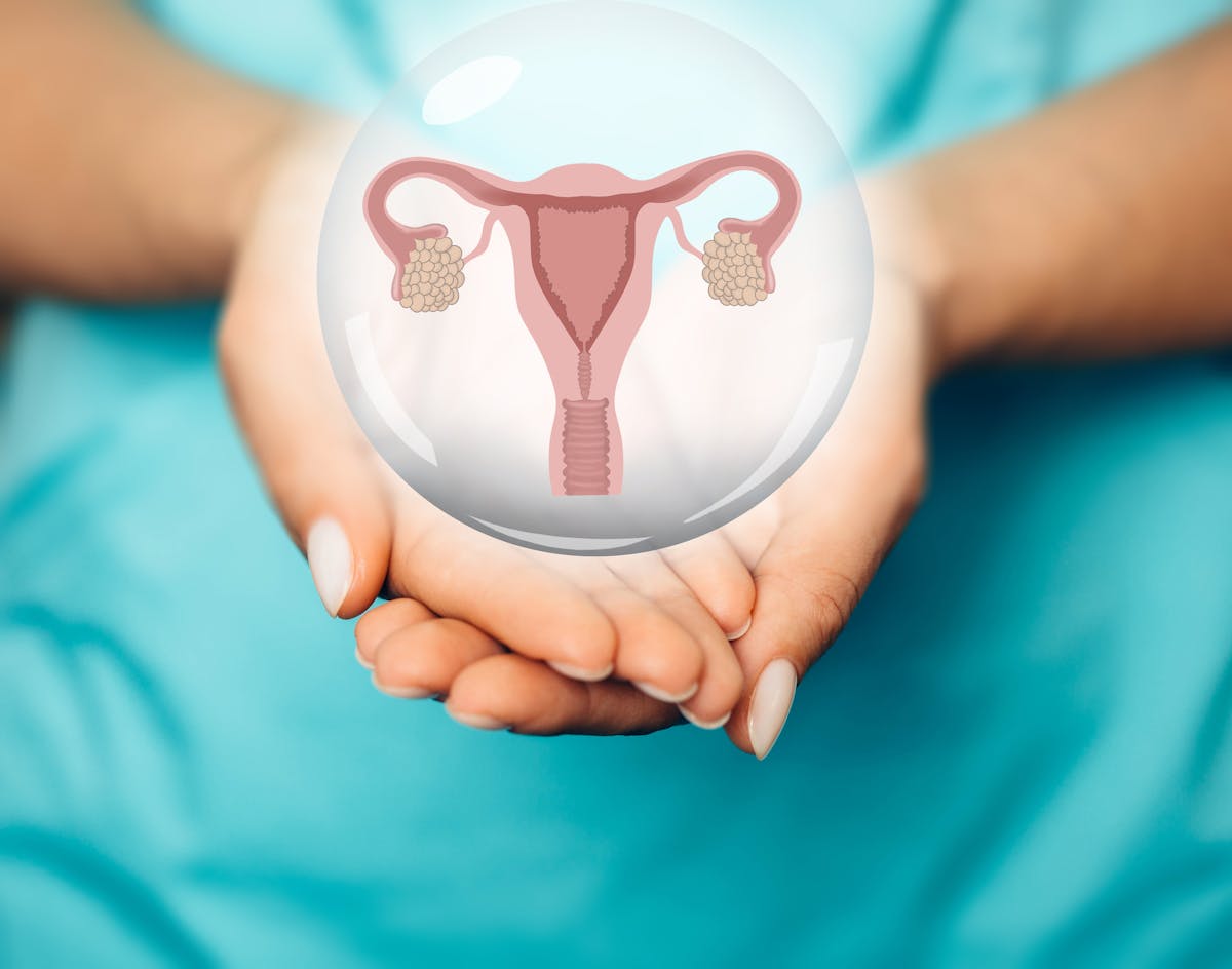 Kyste dermoïde sur l'ovaire : causes et traitements | PARENTS.fr