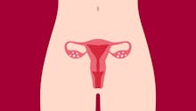 Utérus bicorne : quelles complications possibles sur la grossesse ?