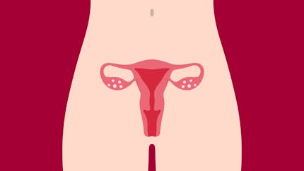 Utérus bicorne : quelles complications possibles sur la grossesse ?