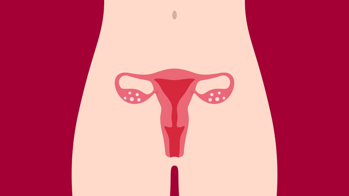L'utérus bicorne augmente le risque de fausse-couche.