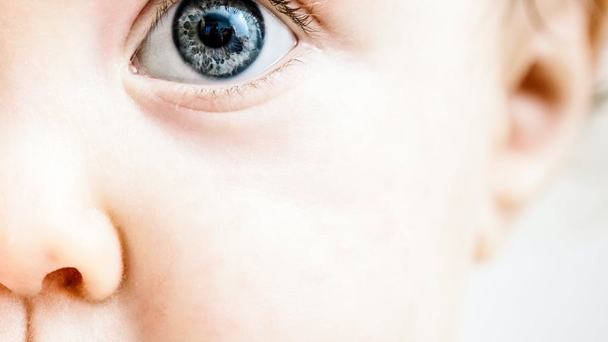 Vision De Bebe Depister Les Problemes Oculaires Parents Fr Vision De Bebe Depister Les Problemes Oculaires Parents Fr