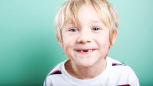 Enfant  : que faire s'il a les “dents du bonheur” ?