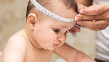 Craniosténose : comment la détecter chez bébé ?
