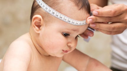 Craniosténose : comment la détecter chez bébé ?