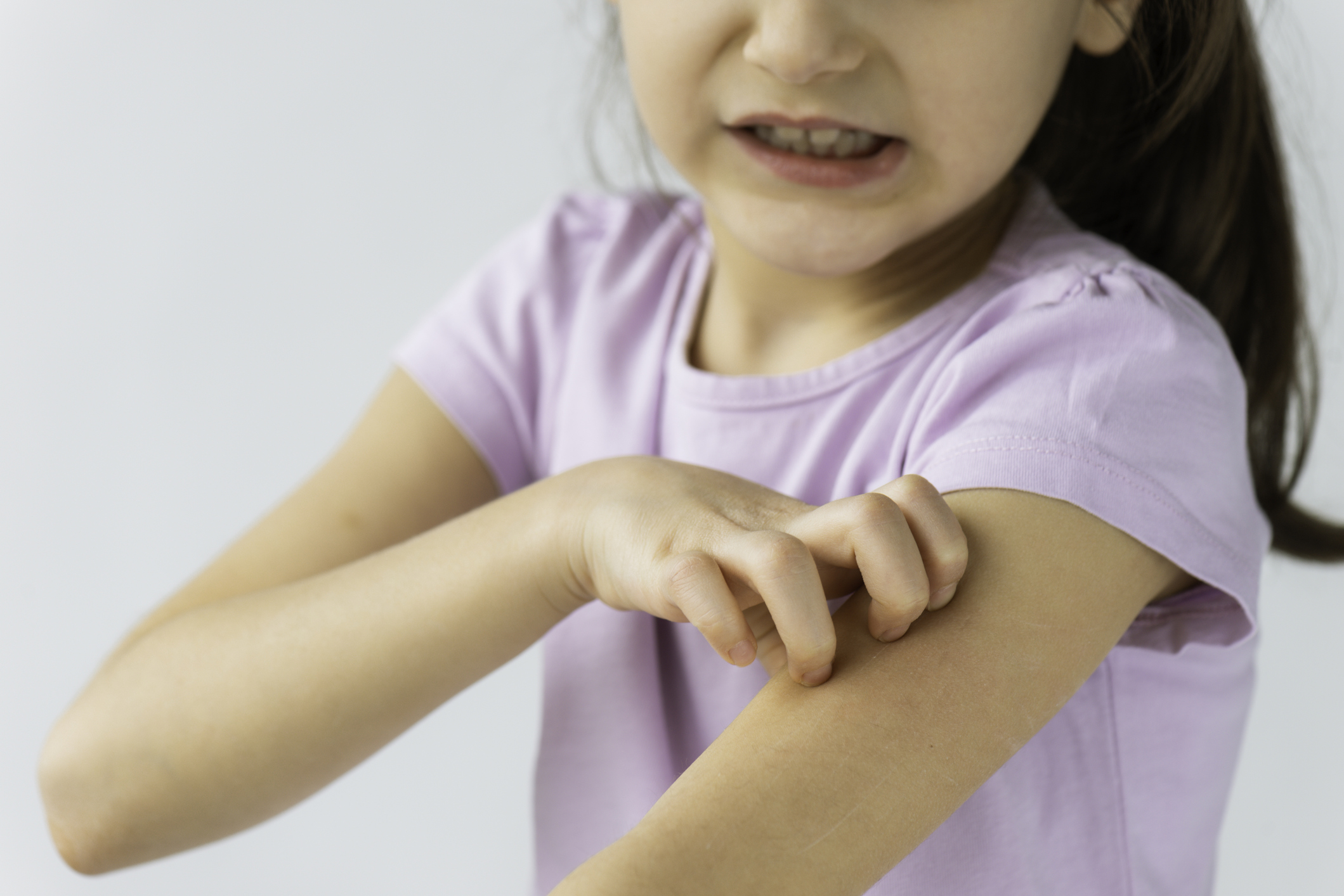 la gale chez l enfant tout sur cette maladie contagieuse parents fr