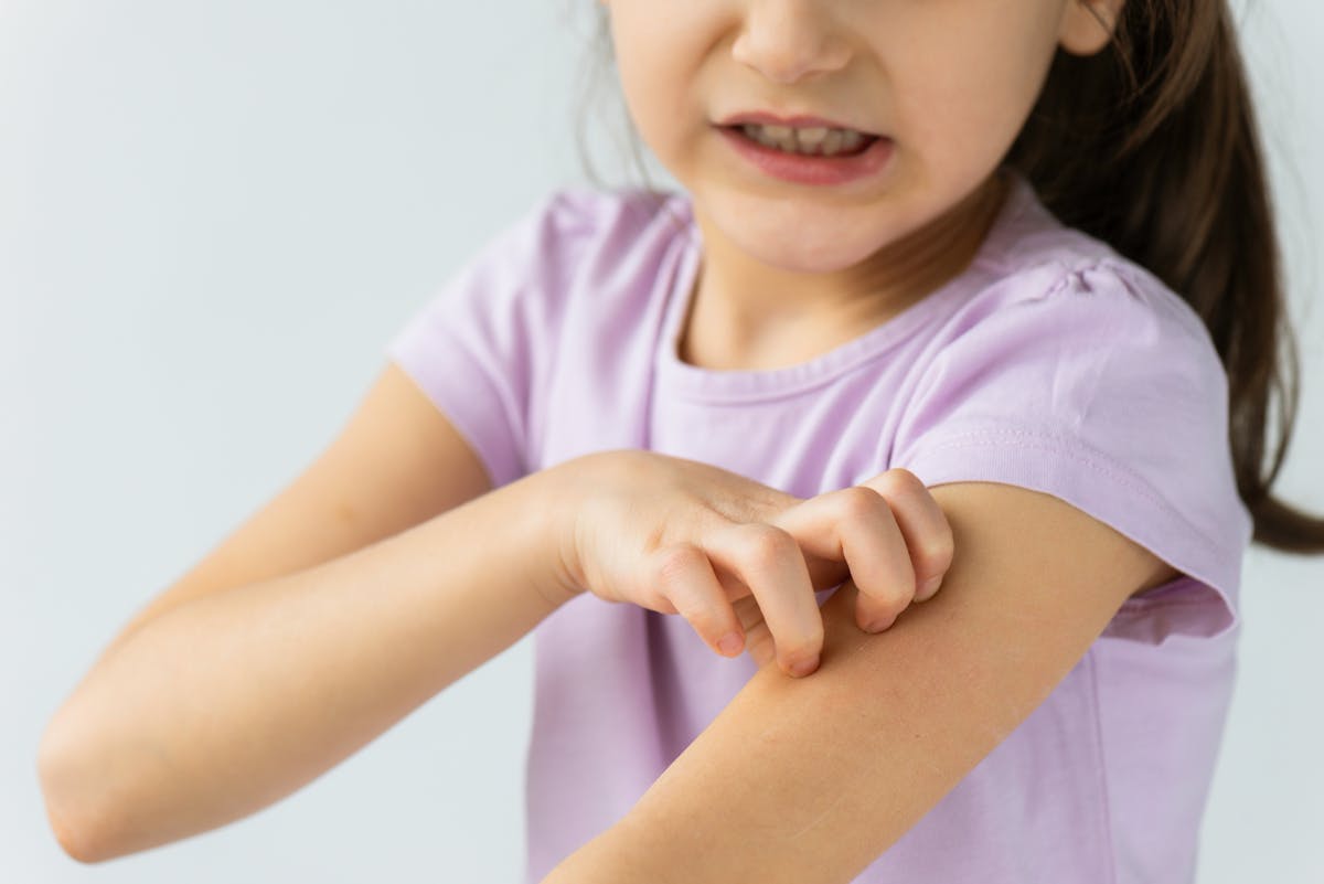 La gale chez l'enfant : tout sur cette maladie contagieuse | PARENTS.fr