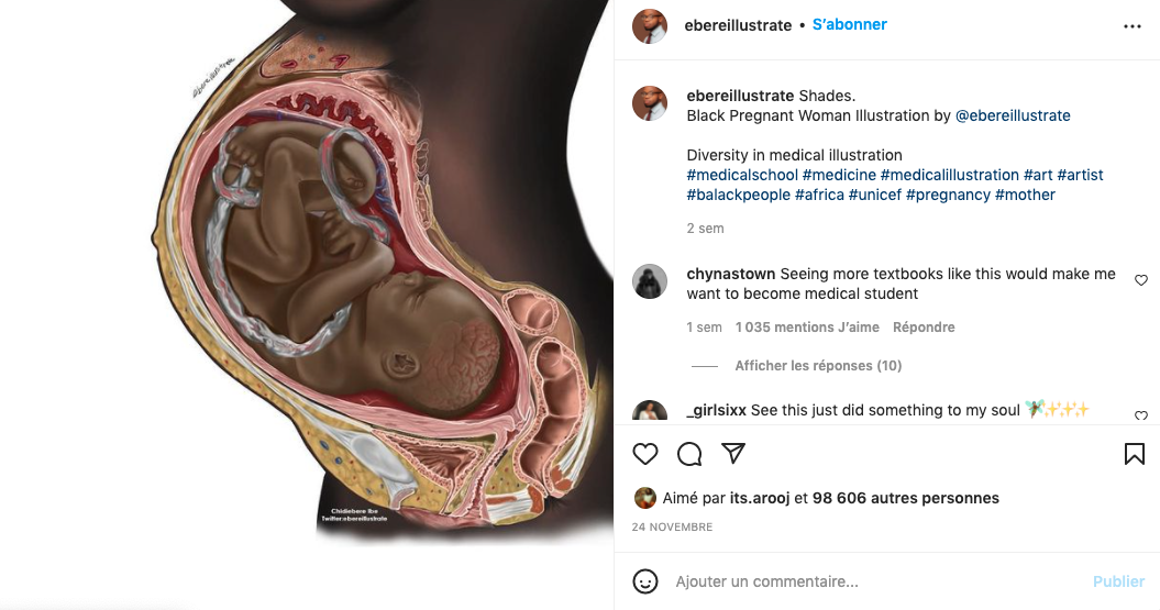 Ce Dessin Anatomique D Un Fœtus Noir Est Devenu Viral Voici Pourquoi Parents Fr