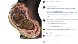 Cette image de fœtus noir a fait le tour du monde