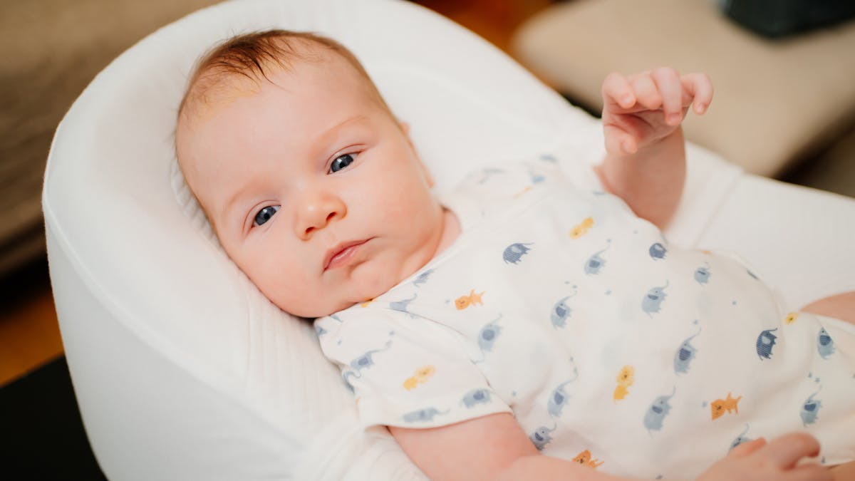 Dermatite Seborrheique Chez Le Bebe Nourrisson Parents Fr Dermatite Seborrheique Chez Le Bebe Nourrisson Parents Fr