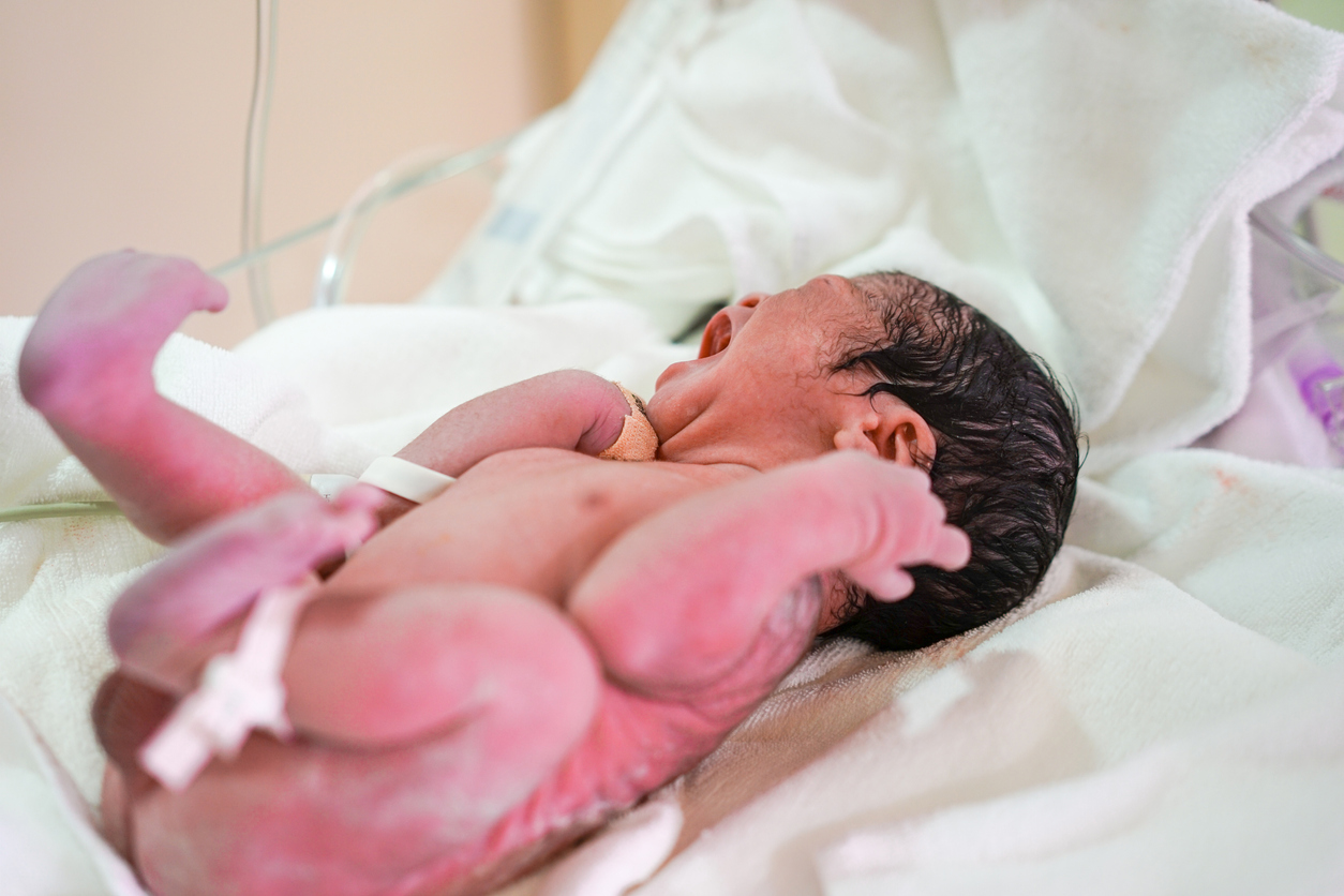 Accouchement Qu Est Ce Qu Un Bebe Sirene Parents Fr