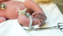 Nouveau-né : comment éviter que le cordon ombilical s'infecte ?