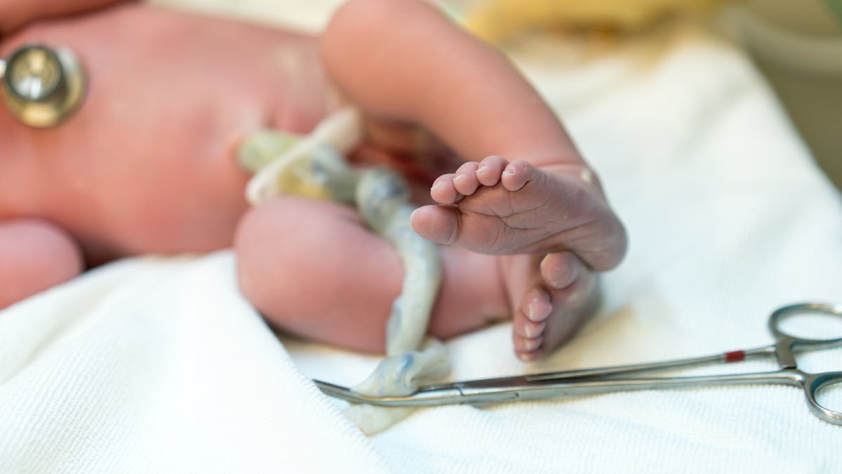 Nouveau Ne Comment Eviter Que Le Cordon Ombilical S Infecte Parents Fr Nouveau Ne Comment Eviter Que Le Cordon Ombilical S Infecte Parents Fr