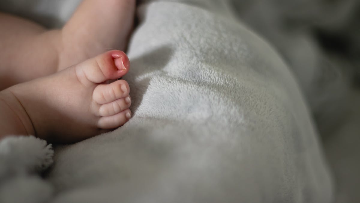 En général bénin, l'ongle incarné chez bébé est tout de même à surveiller, notamment en cas d'infection. 